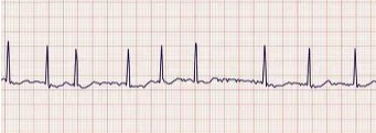 HHC Pharmacy Continuing Education Series - (On Demand) Stay in Sync with the 2023 Guidelines for the Diagnosis and Management of Atrial Fibrillation Banner